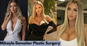 Mikayla Demaiter Plastic Surgery: From Hockey Rink to Instagram Bombshell